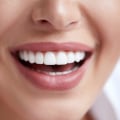 Best Cosmetic Dentist in San Diego: Transforming Smiles with Expertise