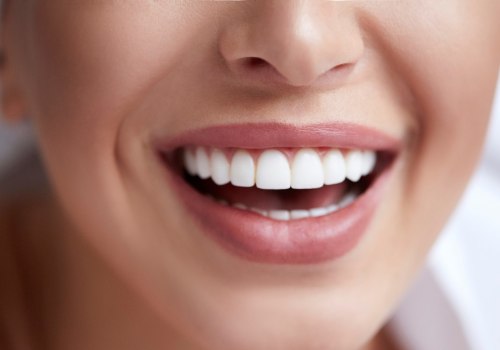 Best Cosmetic Dentist in San Diego: Transforming Smiles with Expertise